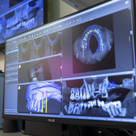 Detailed digital model of a row of teeth on a computer screen