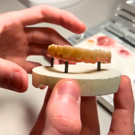 Hands holding a newly crafted denture